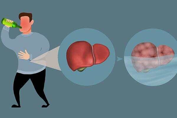 节制酒精摄入对肝脏损伤的预防与保护作用