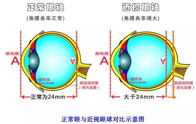 限制屏幕时间保护眼部健康的重要性