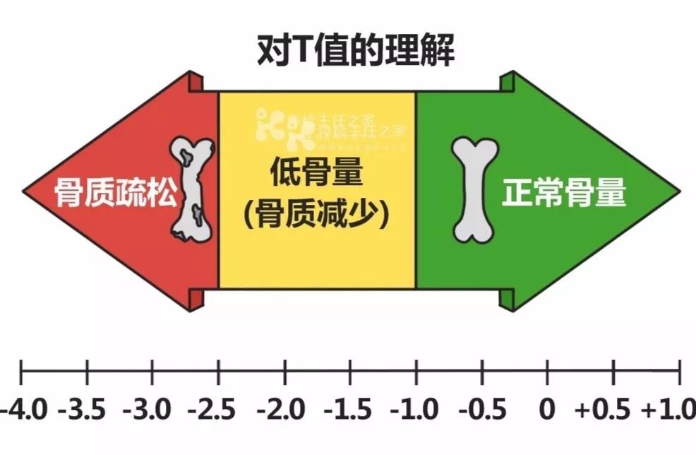 经常跑步对骨密度的积极影响