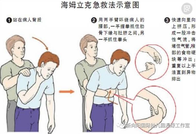 家庭急救指南，切割伤的止血与急救技巧