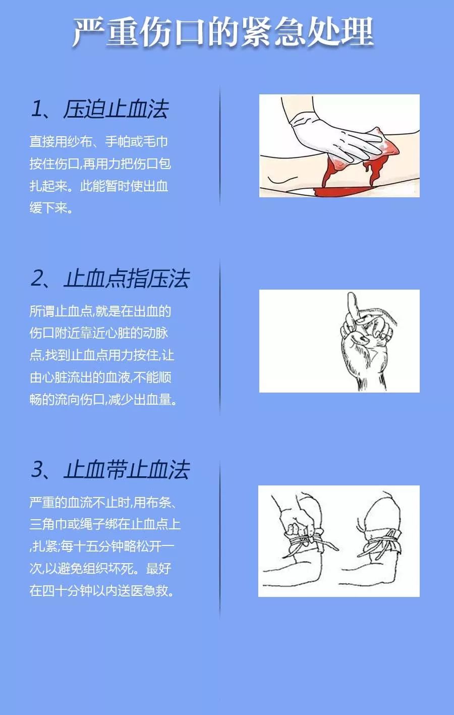 外伤创口的初步处理与应急包使用指南详解